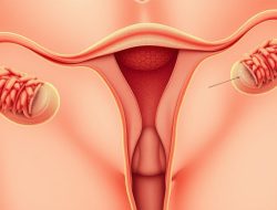 Penyakit Asthenozoospermia: Ketahui Fakta dan Solusinya