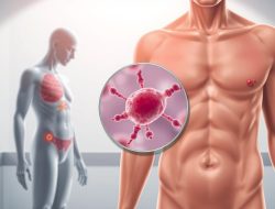 Kenali Gejala dan Pencegahan Penyakit Brucellosis