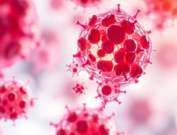 Penyakit Burkitt Lymphoma: Memahami Kanker Darah Langka