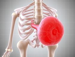 Penyakit Bursitis: Apa yang Perlu Anda Ketahui