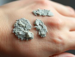 Memahami Penyakit Calcinosis Cutis: Gejala dan Penanganan