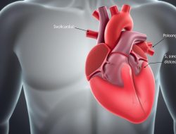 Efusi Perikardium: Kenali Gejala dan Penanganannya