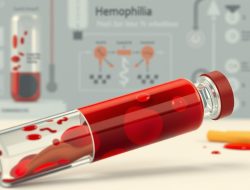 Penyakit Hemofilia: Fakta dan Informasi Penting