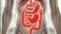 penyakit Gastroparesis