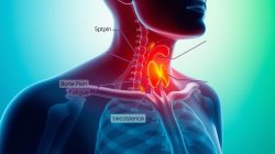 Penyakit Hiperparatiroidisme: Gejala, Penyebab, dan Pengobatan