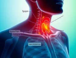 Penyakit Hiperparatiroidisme: Gejala, Penyebab, dan Pengobatan